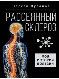 Рассеянный склероз. Моя история болезни