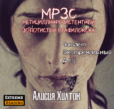 МРЗС